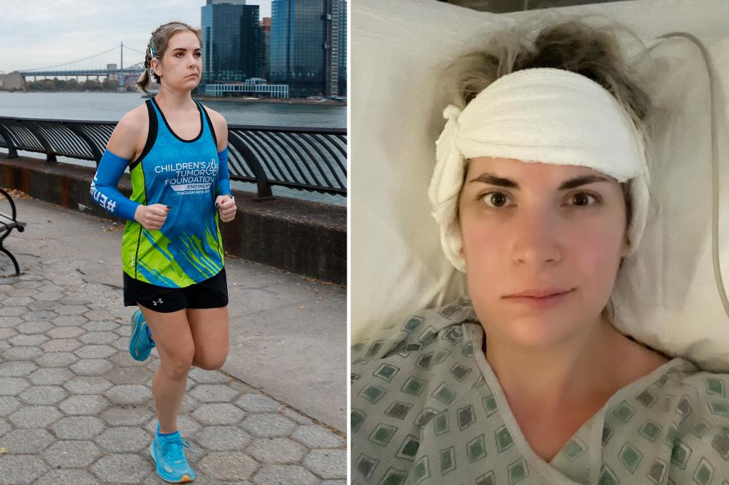 I had brain surgery in January, now I'm running the NYC marathon